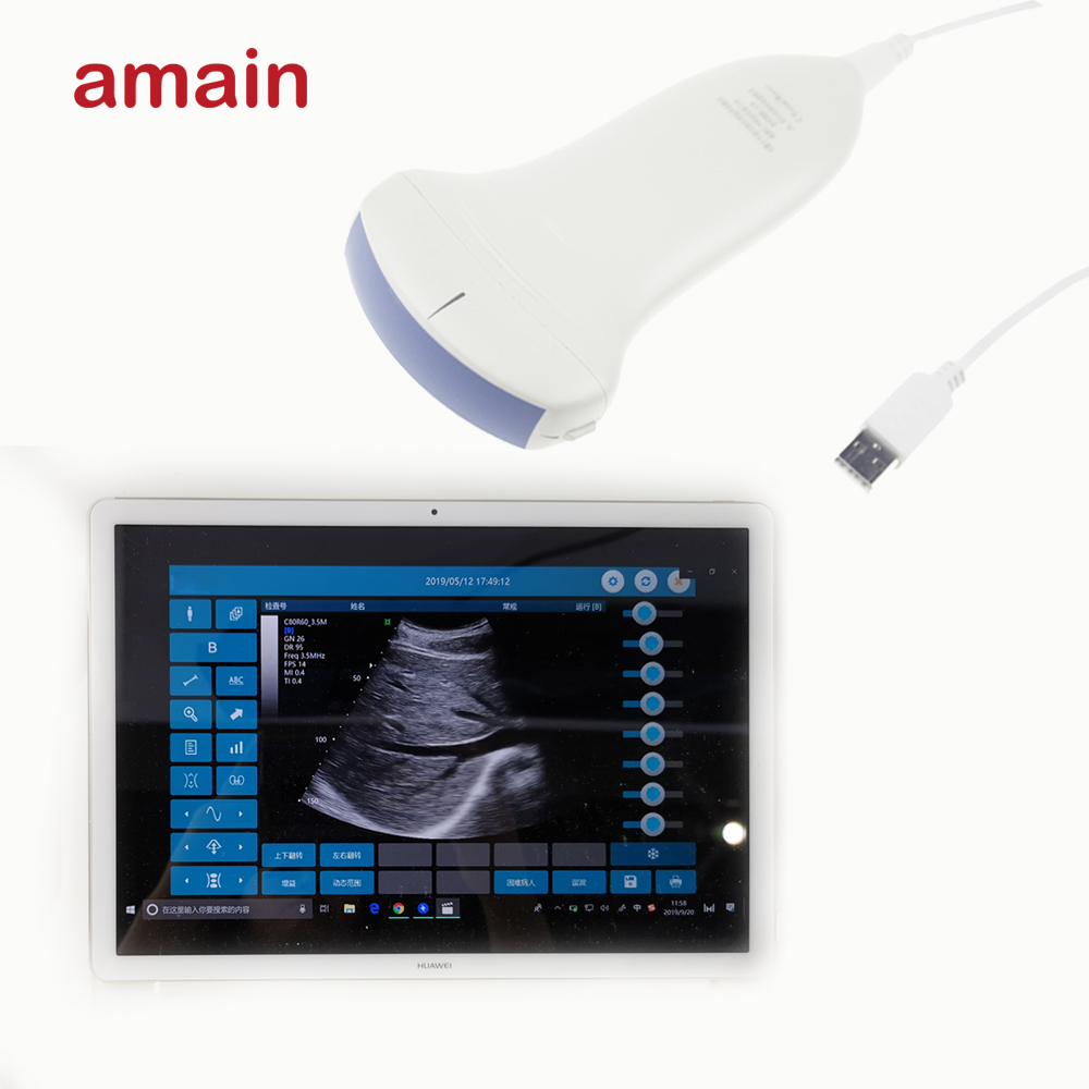 Портативный ультразвуковой сканер Amain MagiQ 2C HD