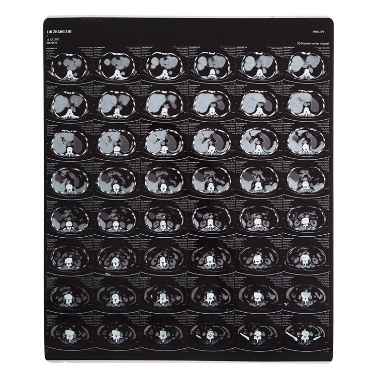 fuji x ray films used in agfa cr radiology equipment
