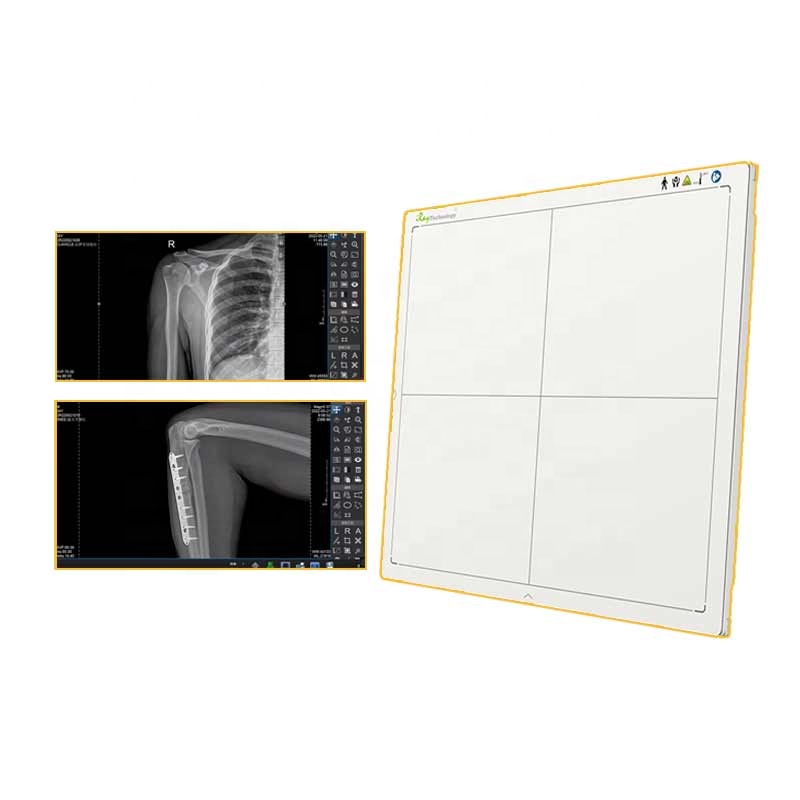 wireless 1417 size DR flat panel detector for human/veterinary diagnostic radiography