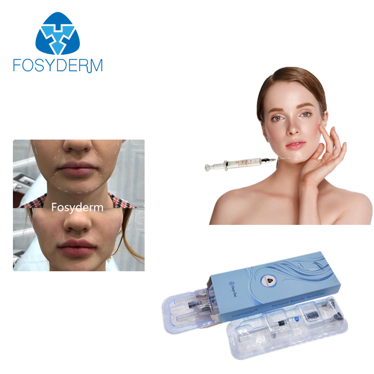 Fosyderm 1 мл глубокое увеличение подбородка дермальный наполнитель гиалуроновой кислоты инъекции