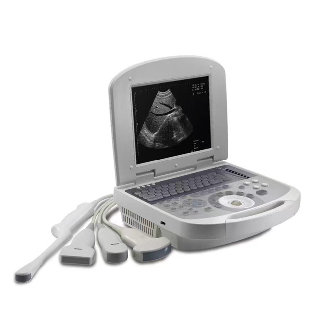 Medical Supplies Sonoscape Medical Ultrasound Instruments Ultrasound Machine Ultrasound System