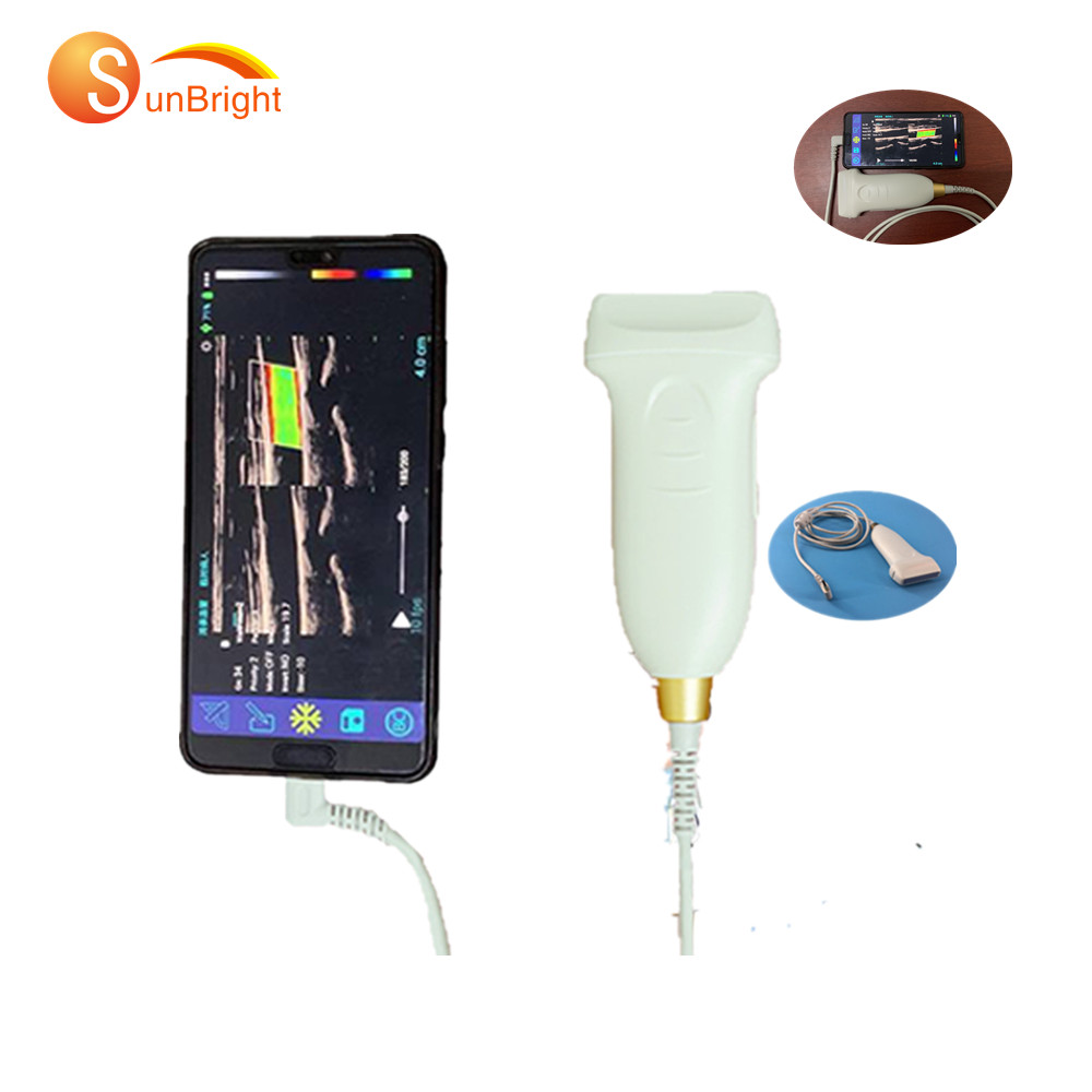 Android USB, ультразвуковой 128 элементов, цветной Доплер, ультразвуковой линейный зонд, допплер, портативный сосудистый аппарат