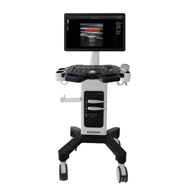 Ulrtrasound Scanner Ultrasound Machine System with High Quality Price for Hospital