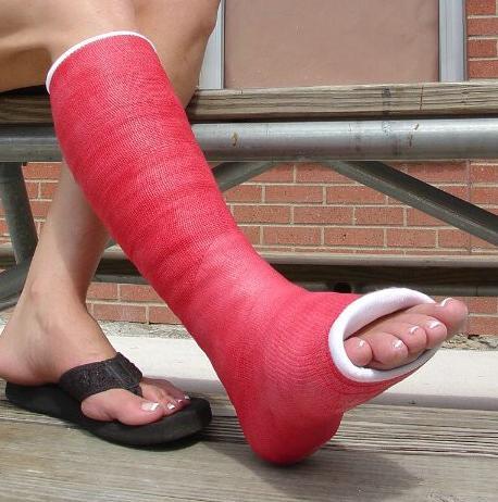Medical Elastic Bandage Protection Cohesive Bandage with Different Color