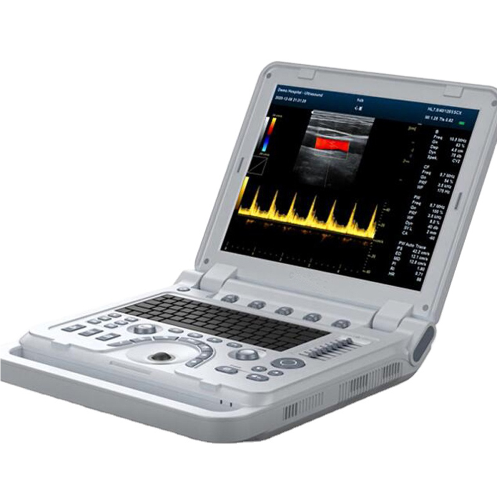 CONTEC Medical Equipment CMS1700B Portable Full Digital Color Doppler Ultrasound Scanner Diagnostic System