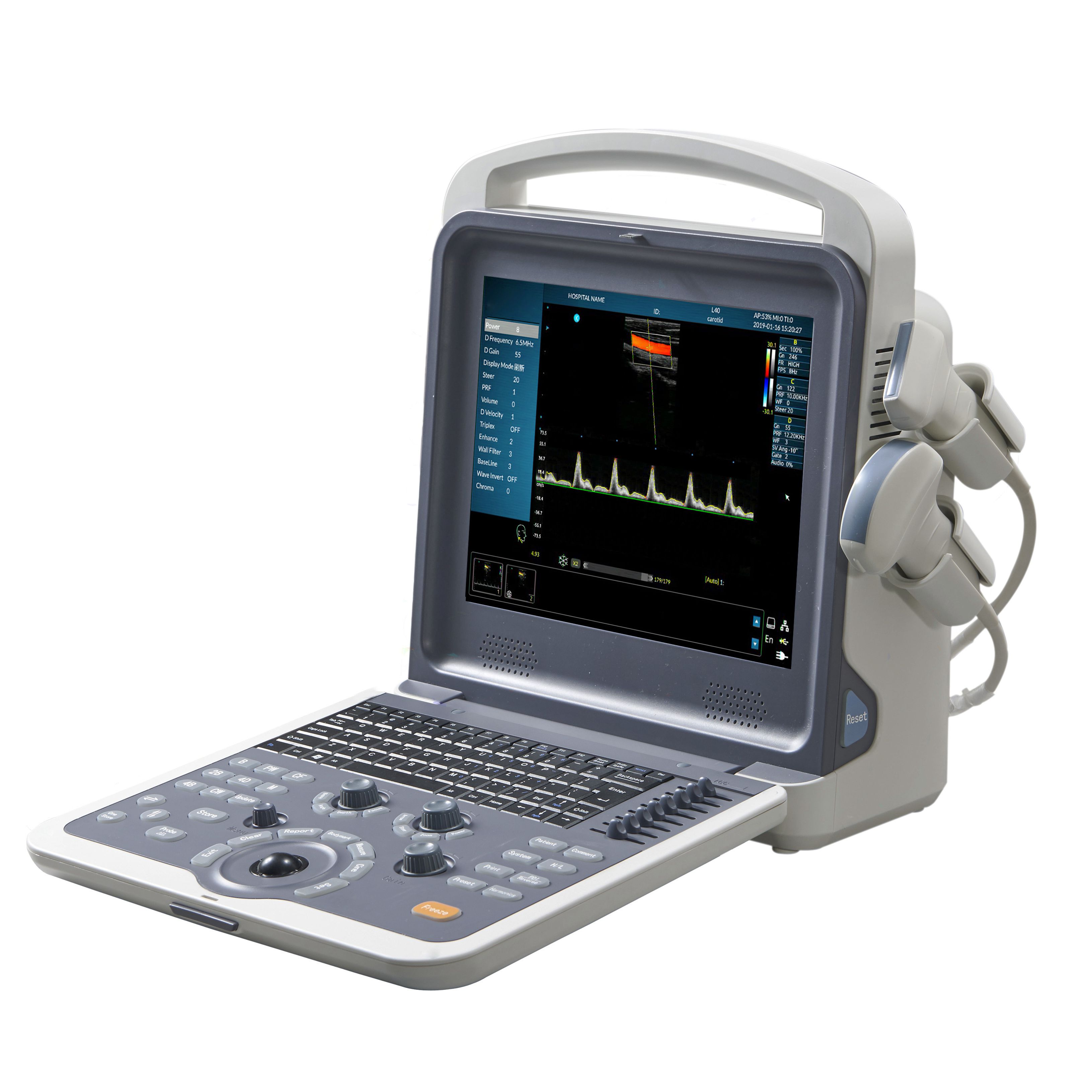 Hospital ultrasonido portatil doppler color ultrasound machine portable