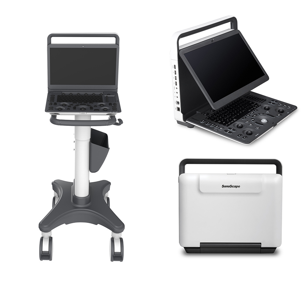Sonoscape e1 exp ecografo 4d abdominal / Vascular / GYN/OB Cardiac ultrasound machine