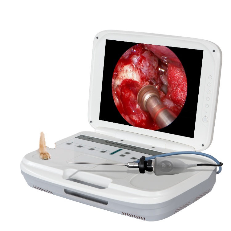 Эндоскоп cystoscope камера с hd камерой и hd монитором