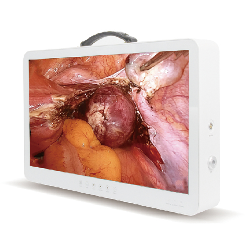 CONTEC CMS-UHD100 MEDICAL Trolley Endoscope Camera For Android