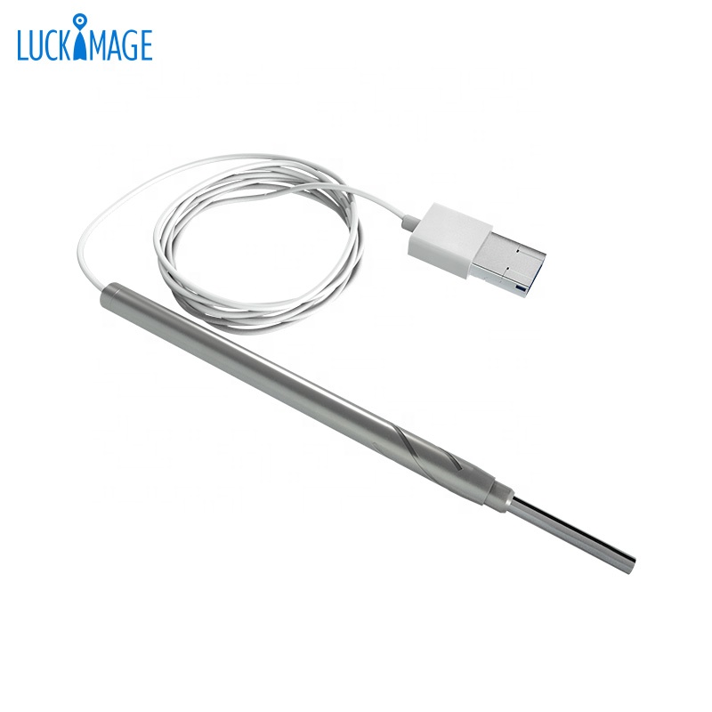 Luckimage digital HD WIFI otoscope with camera Shenzhen for sale