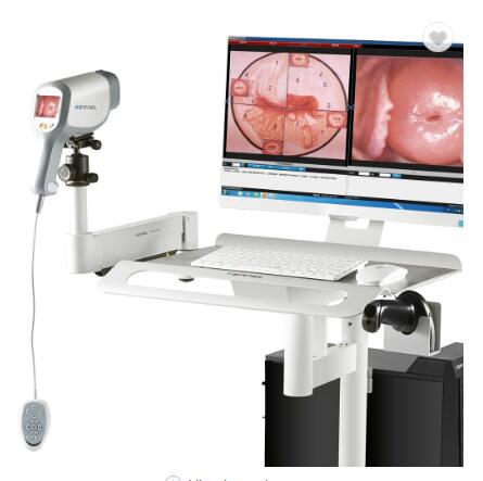 Medical CE Digital colposcope gynecology vagina examination medical device KN-2200