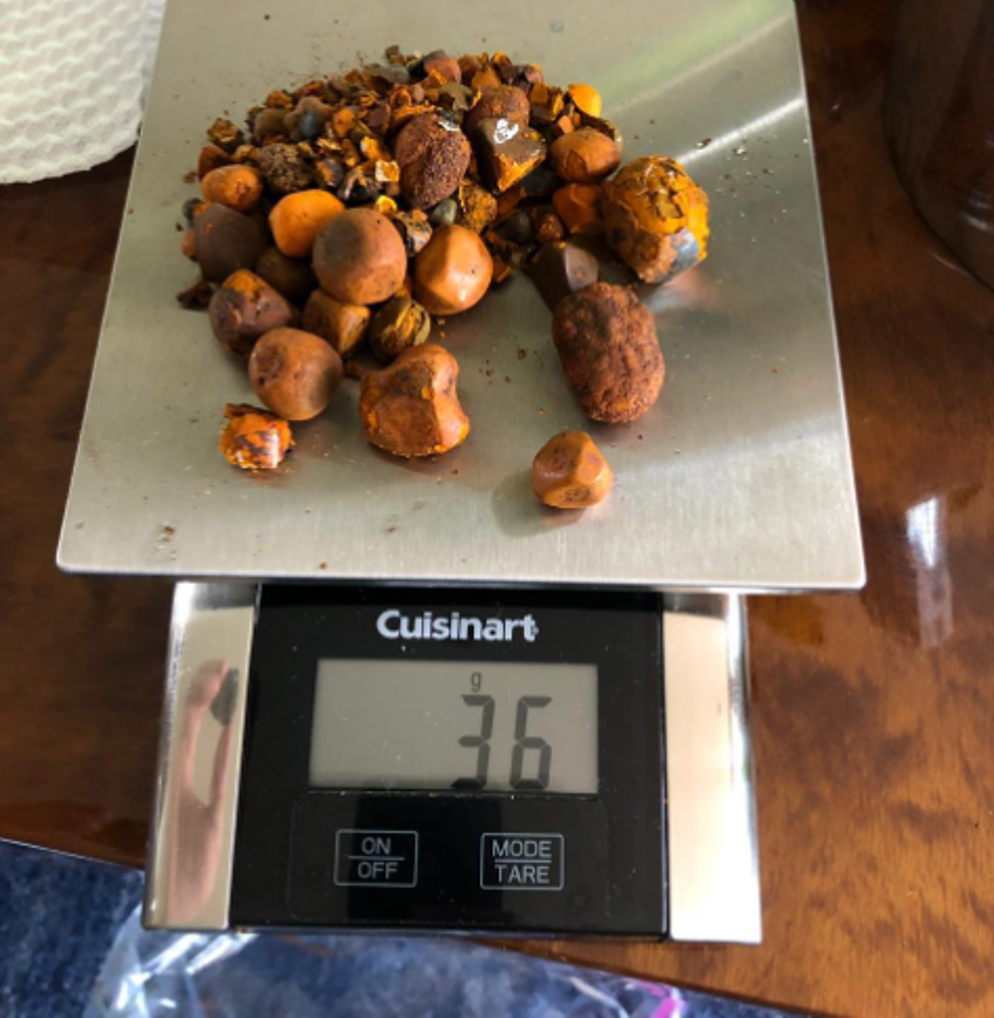 Premium Quality Bezoar Gallstones for Sale/ 100% Original and Halal