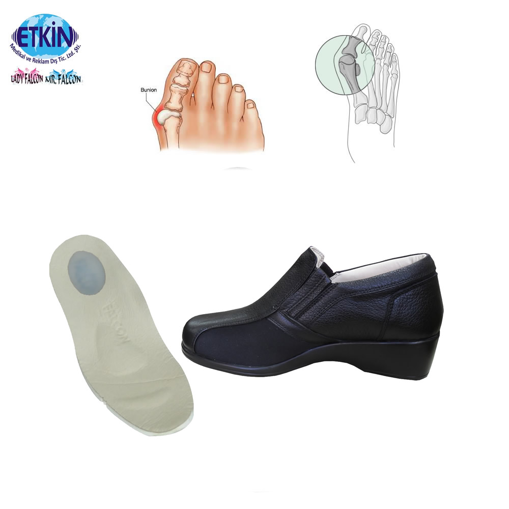 Лучшая ортопедическая модель обуви Bunion с кожаной силиконовой пяткой для облегчения боли в пятке