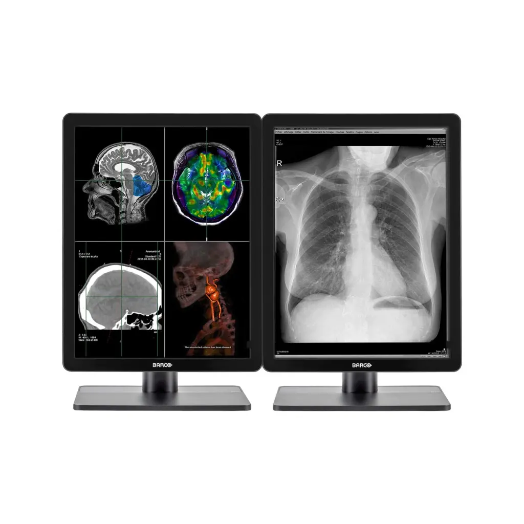 Medical monitor Barco