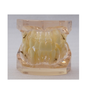 Modèle orthodontique 24 pièces sans bracket, modèle d'étude dentaire, démonstration orthodontique pour la pratique et l'enseignement en dentisterie - Product Image 1