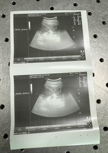 Appareil à ultrasons GE LOGIQ P5 modèle 2010 avec sonde linéaire 12L et sonde convexe C4 8 - Product Image 5
