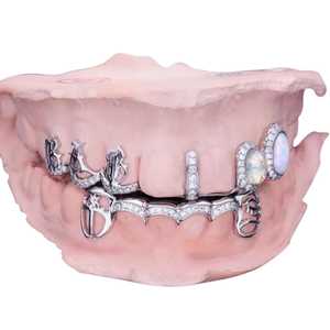 Grillz personnalisés en or fin 14 carats avec moissanite taille brillant ronde et opale – Unisexe Or blanc/jaune/rose - Product Image 1