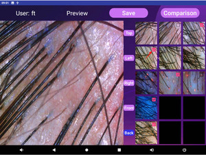 Miễn phí Thuế nhanh chóng tìm kiếm da đầu Tester tìm thấy khách hàng theo số điện thoại - Product Image 6