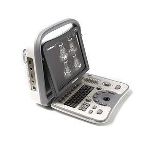 Appareil d'échographie portable Sono Scape A6 - Product Image 1