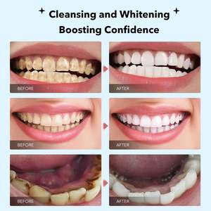 Pasta Dental Blanqueadora SP-6 con Probióticos Lactobacillus para Equilibrio del Microbioma Bucal, Eliminación de Manchas y Aliento Fresco, 120g - Product Image 5