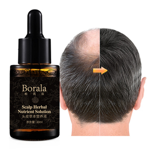 Borala Productos anticaída del cabello Tratamiento de la calvicie Hombres Mujeres Aceite <span class=keywords><strong>para</strong></span> el crecimiento del cabello - Product Image 1
