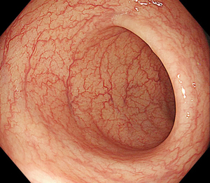 Système de gastroscope vétérinaire HD portable et léger le plus vendu-GU pour le diagnostic et le traitement des grands animaux