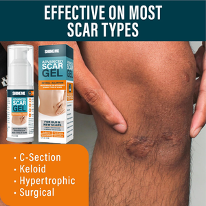 Daggebruik Beste Littekenverwijderingsgel Voor Keloïde, Acne, Brandwonden, Chirurgie-Snelle Genezing, Hypoallergeen Door Klinisch Getest - Product Image 2