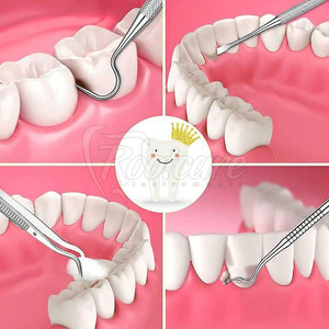 Kits de Exploración Dental de Nueva Llegada, Kits de Exploración Dental de Color Personalizado para Venta en Línea - Product Image 5