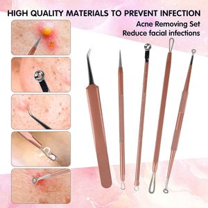 Ensemble de 12 pièces de luxe pour manucure et pédicure, extracteur de points noirs, traitement de l'acné, coupe-ongles en acier inoxydable, best-seller - Product Image 5