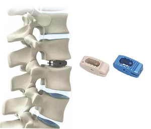 อุปกรณ์ศัลยกรรมสัตวแพทย์ Solingmed SM-444 สำหรับการผ่าตัดฝังรากฟันเทียมแบบ Peak TLIF ทำจากสแตนเลส ได้รับการรับรองมาตรฐาน CE สำหรับการผ่าตัดกระดูกสันหลังส่วนหลัง - Product Image 4