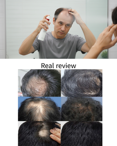 Coréen 100% Naturel Soins Du Cuir Chevelu Laque Fusion-Probiotiques Huile-Contrôle Anti-Perte De Cheveux Repousse Des Cheveux Unisexe Prévention De La Perte De Cheveux - Product Image 6