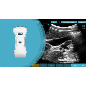 Ultrassom Doppler Colorido Sem Fio Portátil de Cabeça Dupla 2026 com Sonda 3 em 1 para Melhor Preço MSLMY10P - Product Image 5