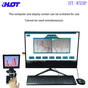 Chuyên nghiệp nailfold vi tuần hoàn màn hình cho Bệnh Tiểu Đường chăm sóc các biện pháp tế bào máu Loại Tốc Độ kính hiển vi - Product Image 2