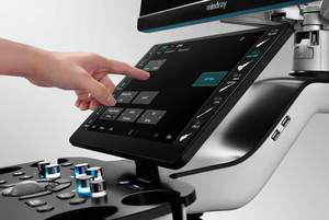 Sistema de Diagnóstico por Imágenes de Ultrasonido Portátil Premium con IA Avanzada, Escáner Médico Doppler para Radiología y Cardiología - Product Image 3