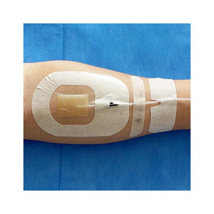 Chirurgische EO selbst klebende Dressing CHG Transparent IV Dressing Aseptische medizinische Einweg produktion - Product Image 5