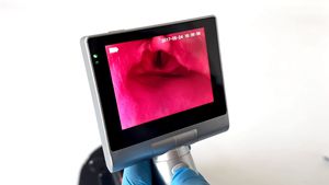 Draagbare Herbruikbare Blade Médical Laringoscopio Video Laryngoscoop Set Voor Anesthesie Intuberende Middel Endoscoop Fabriek Prijs - Product Image 6