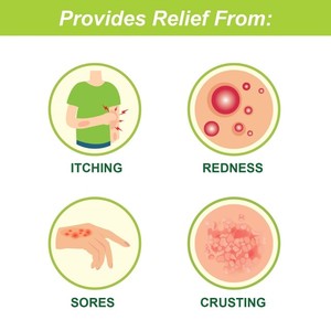 Tetmosol 100Gm Thuốc Xà Phòng Thanh Ấn Độ Lime Hương Thơm Chống Vi Khuẩn Tắm Xà Phòng Sáng Tính Năng Giúp Chống Nhiễm Trùng Da - Product Image 3