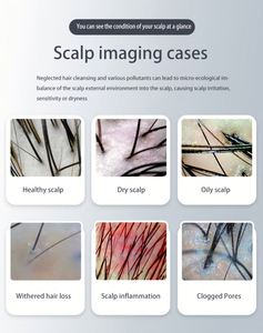 High Definition 3 in 1 Scalp Hair Skin Analyzer Detector <b>Digital</b> <b>Microscope</b> Hair Loss Test Machine for Barber Shop Clinic - Product Image 4