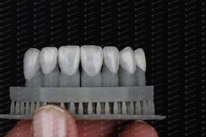 Yucera 3D-Pro Multicouche Pré Ombré Zircone Dentaire Couronnes Dentaire CAD CAM Bloc De Zircone - Product Image 3