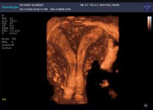 Hot Selling Trolley Medische Echografie-apparaat Sonoscape P15 met een lage prijs - Product Image 5