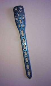 ชุดเครื่องมือสำหรับศัลยกรรมกระดูกและข้อแบบพิเศษของเยอรมันแผ่น Philos LCP 3.5เครื่องมือเกี่ยวกับศัลยกรรมกระดูกวัสดุเหล็กแบบแมนนวล - Product Image 2