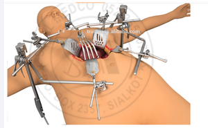 Bonne offre Thompson Retractor System Instruments orthopédiques chirurgicaux - Product Image 3