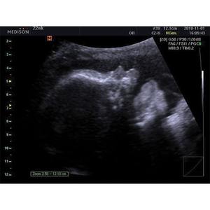 Máquina de Ultrasonido Samsung SonoAce R5 - Product Image 6