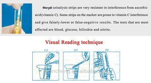 Hongyi URS-2P personnalisation bon marché in vitro Diagnostics 2 en 1 bandelettes de <span class=keywords><strong>Test</strong></span> d'urine rapide URS-2P - Product Image 6