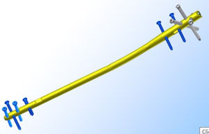 เครื่องมือผ่าตัดไทเทเนียมพร้อมตะปูหน้าแข้งทำจากสเตนเลส - Product Image 4