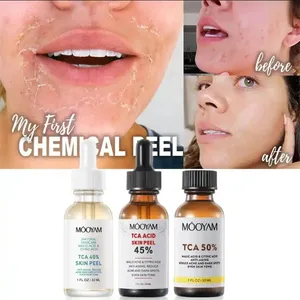 Haut TCA 40% 45% 50% Chemical Peel Profession elles chemisches Peel-Serum für Haut entferner für dunkle Flecken