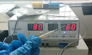 Unidad Electroquirúrgica de Alta Frecuencia (MTR MTR-ME-80) al Mejor Precio para Uso Hospitalario, Maquinaria con Certificación CE - Product Image 3