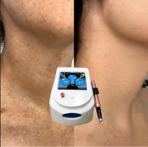 Machine de bureau fixe pour le traitement des tatouages au laser Nd YAG, le traitement des pigments, le <span class=keywords><strong>peeling</strong></span> au carbone, le blanchiment de la peau au laser Pico, l'élimination des taches de rousseur - Product Image 1
