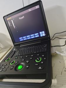 Échographe Doppler Couleur Portable 3D/4D pour Clinique Vétérinaire et Hôpital pour Animaux - Product Image 4