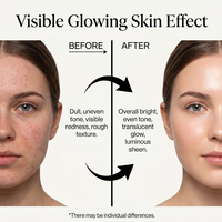 Sérum Visage Éclaircissant et Hydratant à la Vitamine C de Cerise Acerola, Niacinamide, Alpha Arbutine et Acide Tranexamique – Marque Privée OEM/ODM